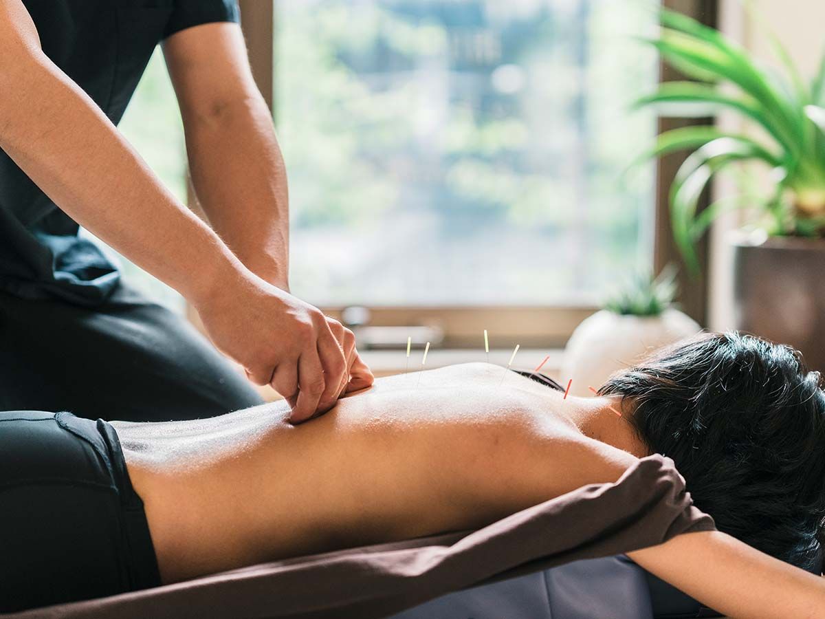 Person lying face down on a table receiving acupuncture, with several needles inserted in their back; therapist's hands are visible. Indoor setting with plants in the background highlights modern acupuncture technology.